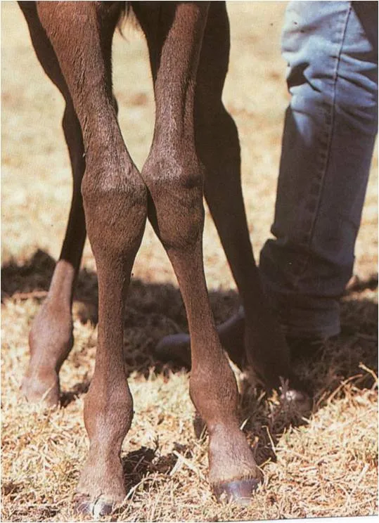 Valgus carpiano